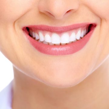 Thinking of Getting Dental Bridges? Here’s What You Need to Know
