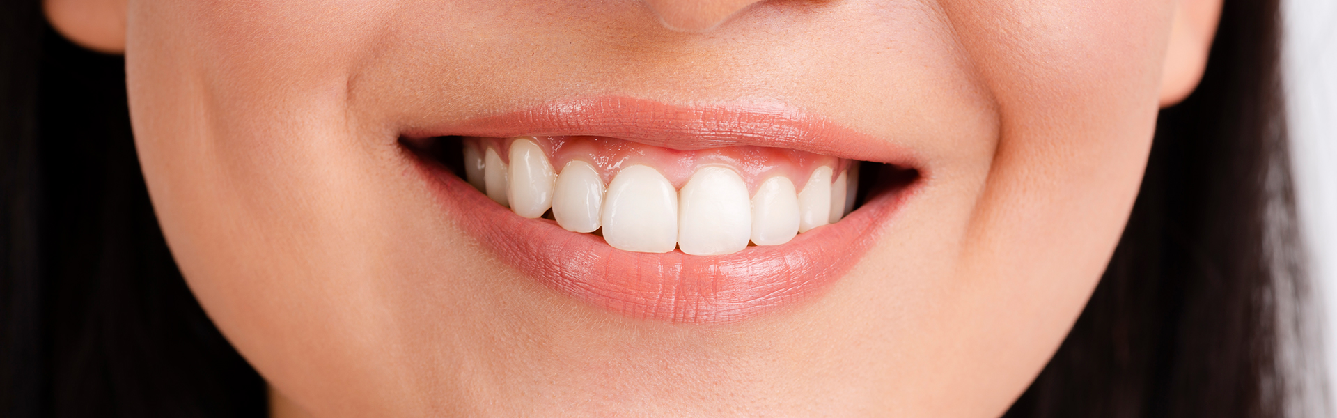 The Benefits of a Complete Smile Makeover for Your Appearance and Health